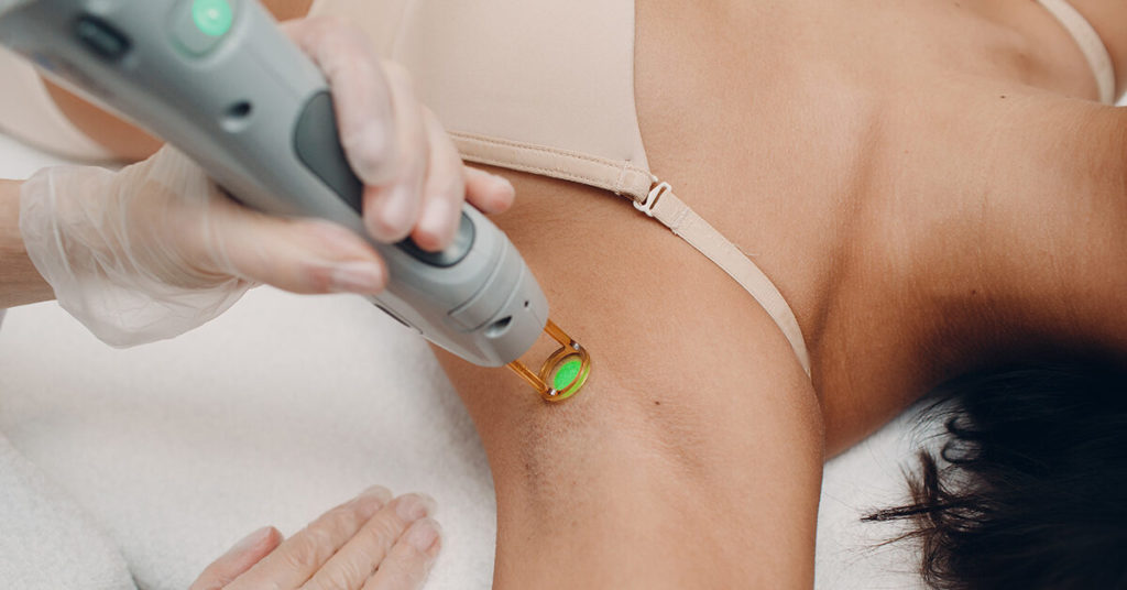 Why Should You Consider Laser Hair Removal?
