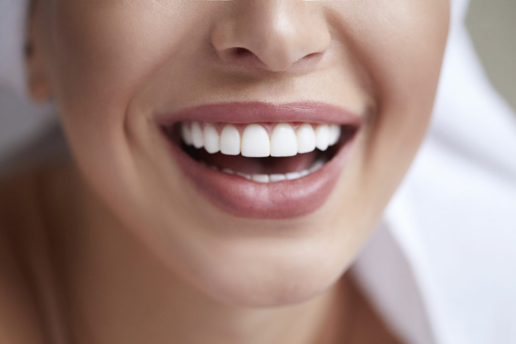 All You Need to Know About Veneers