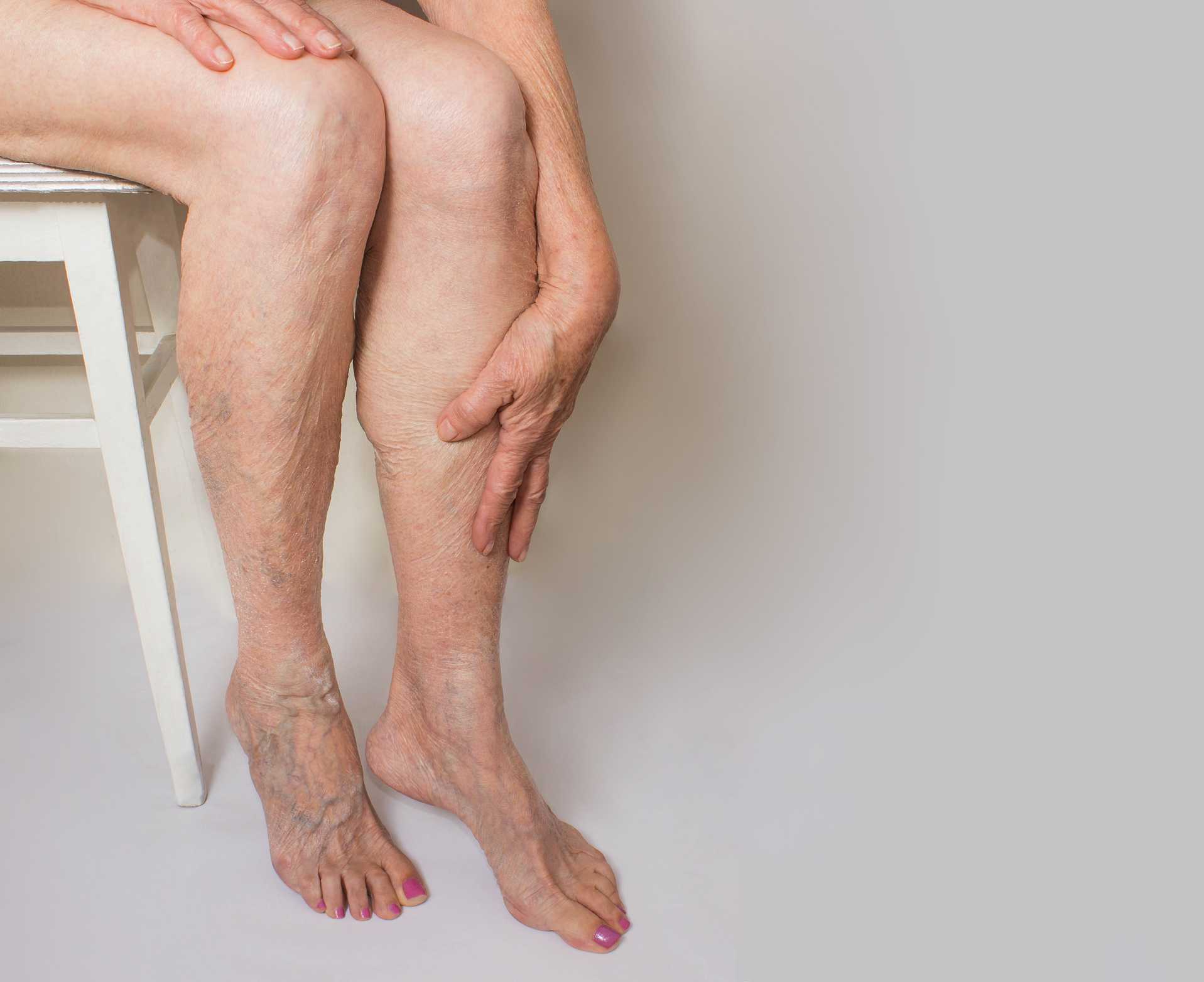 Health Concerns Likely to Arise with Peripheral Arterial Disease