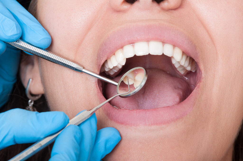A Dentist’s Guide to Good Oral Health