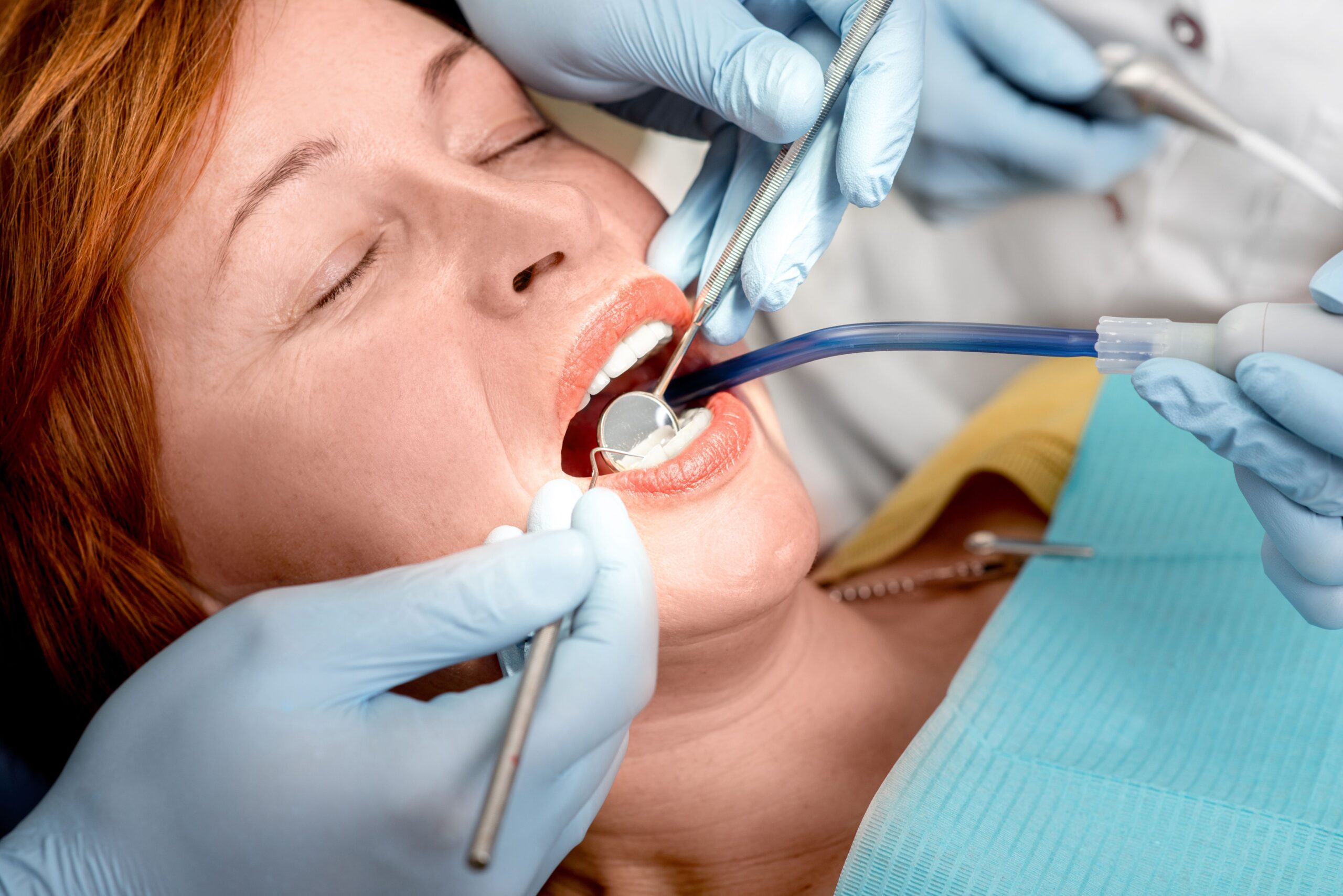 Five Reasons to Take Professional Dental Cleanings Seriously in Fort Walton Beach