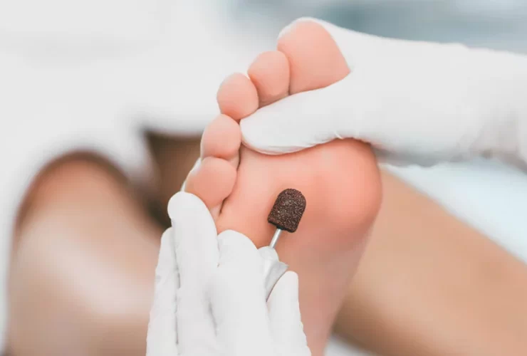 Role Of Podiatrists