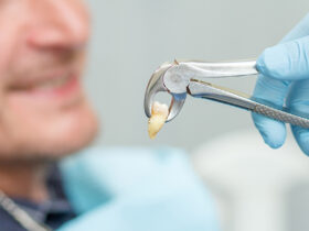 Wisdom Teeth Removal