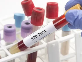 STD Testing
