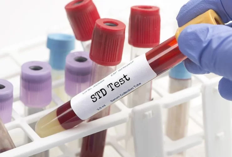 STD Testing