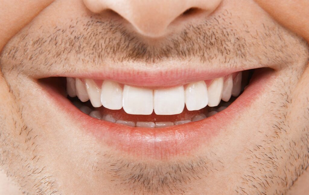 The Role of AI in Smile Design: Predicting the Perfect Look