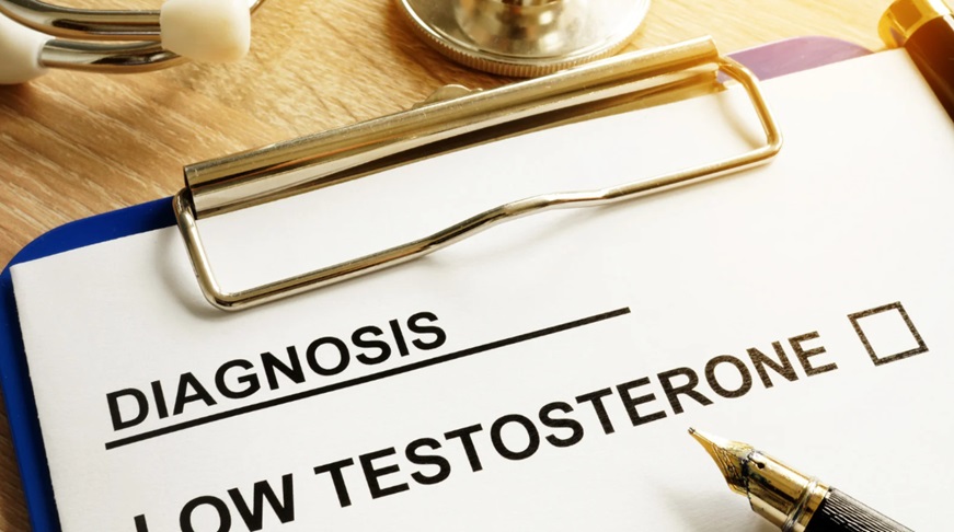 Testosterone Replacement Therapy
