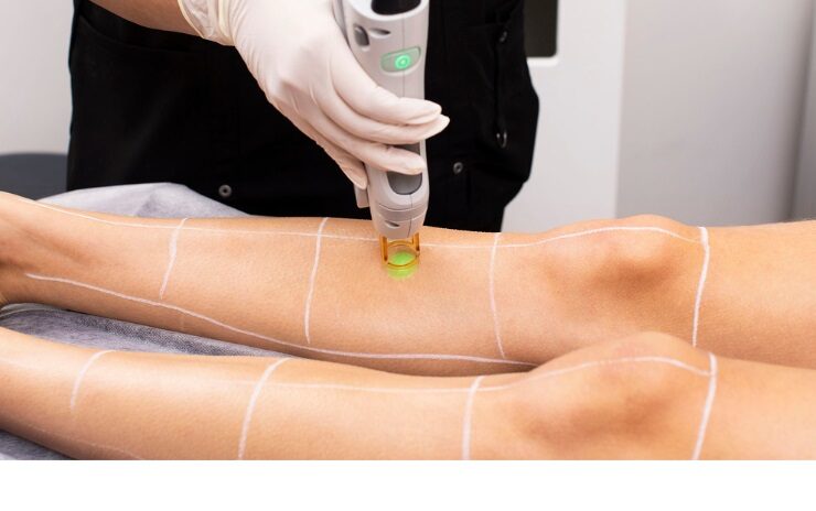 Is Full Body Laser Hair Removal Worth It? Breaking Down the Cost and Benefits