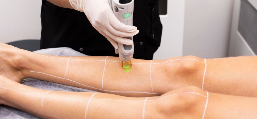 Is Full Body Laser Hair Removal Worth It? Breaking Down the Cost and Benefits